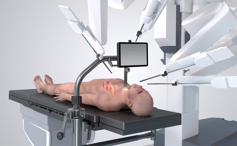 Scottish company makes key global breakthrough in robot-assisted heart surgery